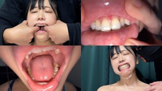 NKO-700001 觀察鈴醬口水直流時的口腔內部。
