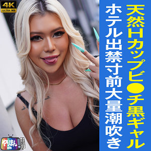 R짱